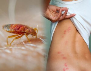 bed bug control service